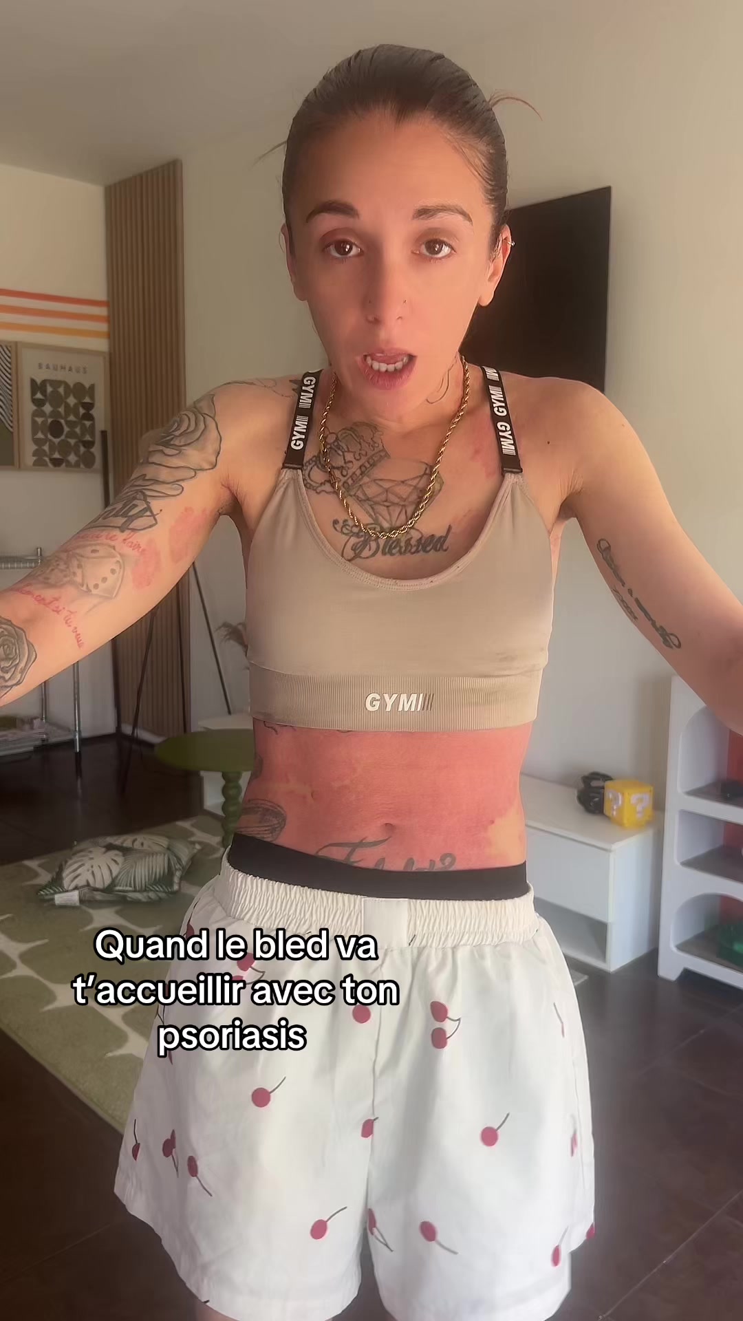 @lyla_psoriasistyle