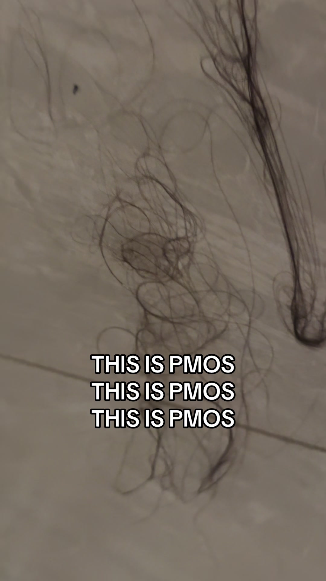 @Sarah | PMOS life + tips