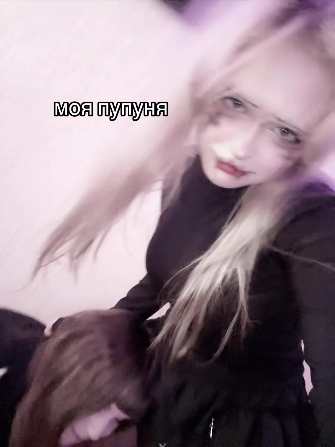 @uglyrosis