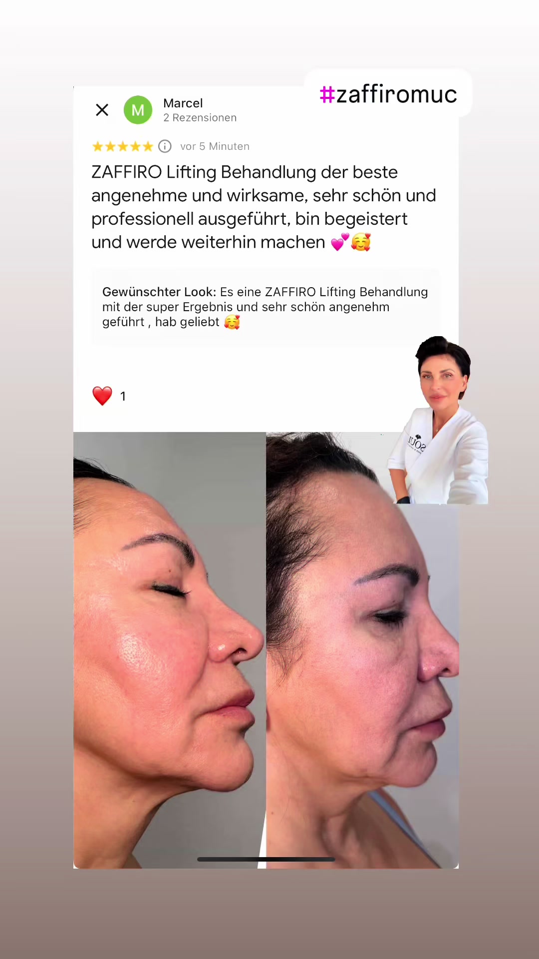 @soul_laeseraesthetic