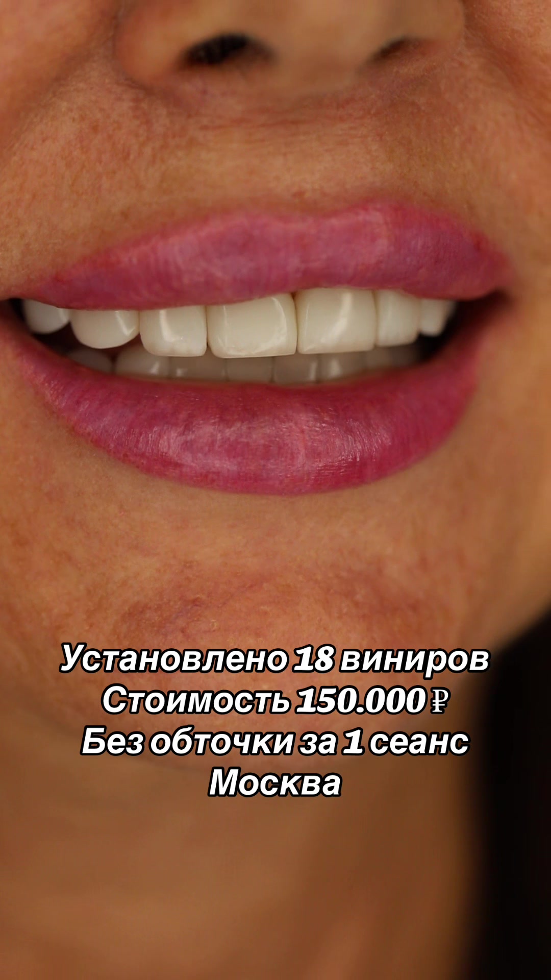 @Royal_smile_moscow