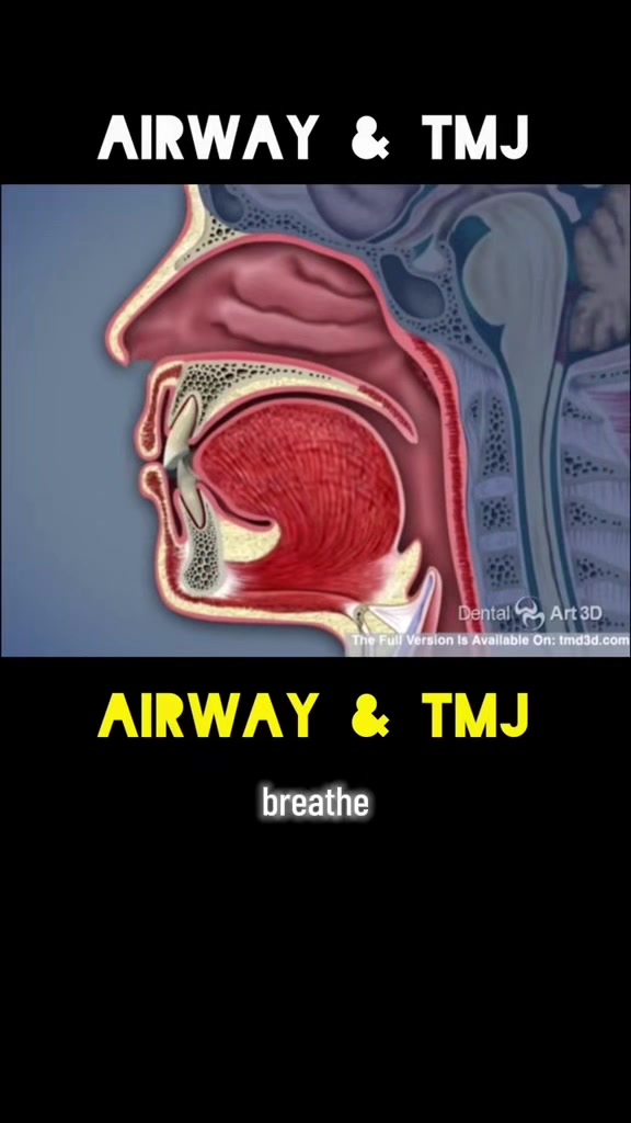 @Airway Champion