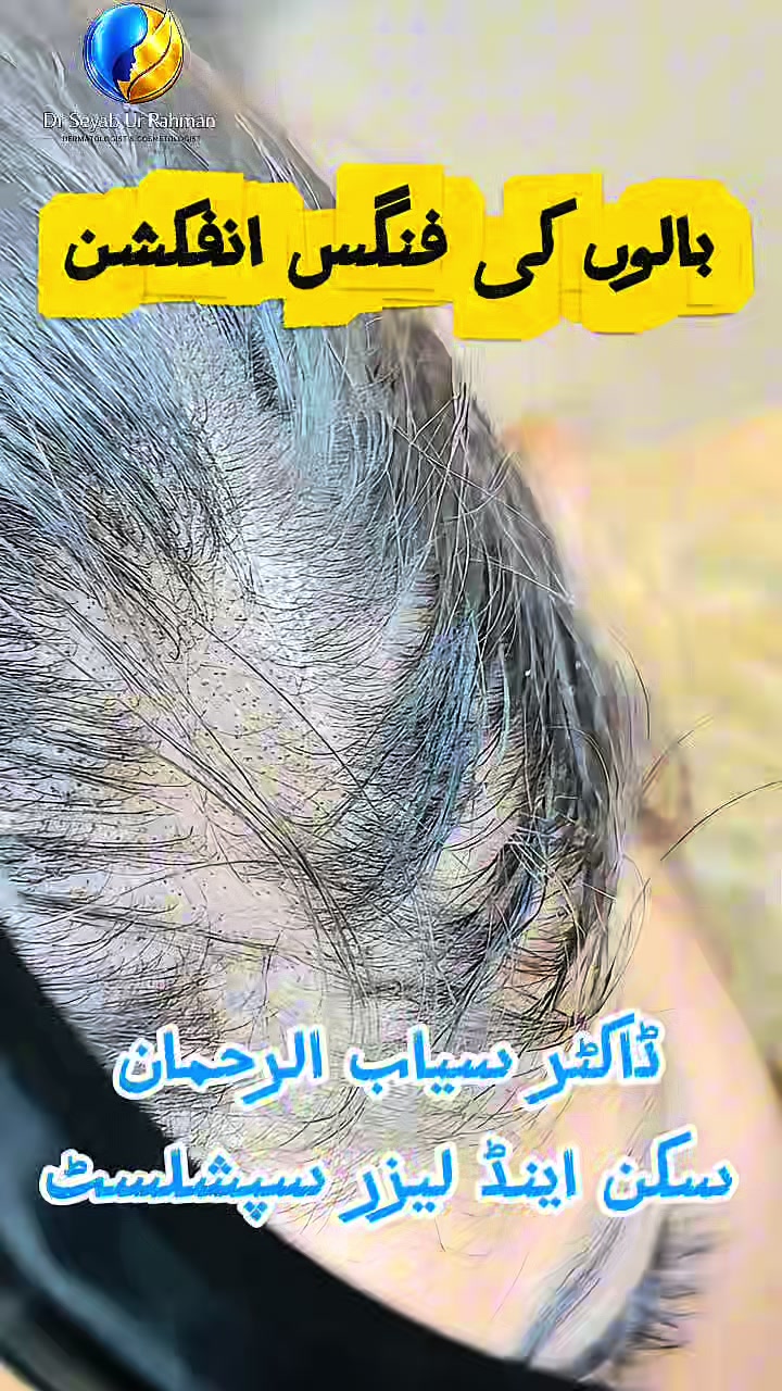 @Dr seyab Dermatologist