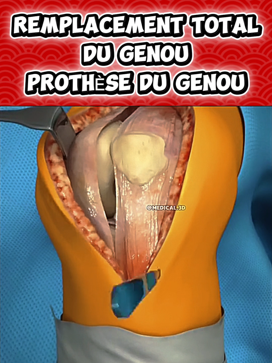 @Docteur Shepherd