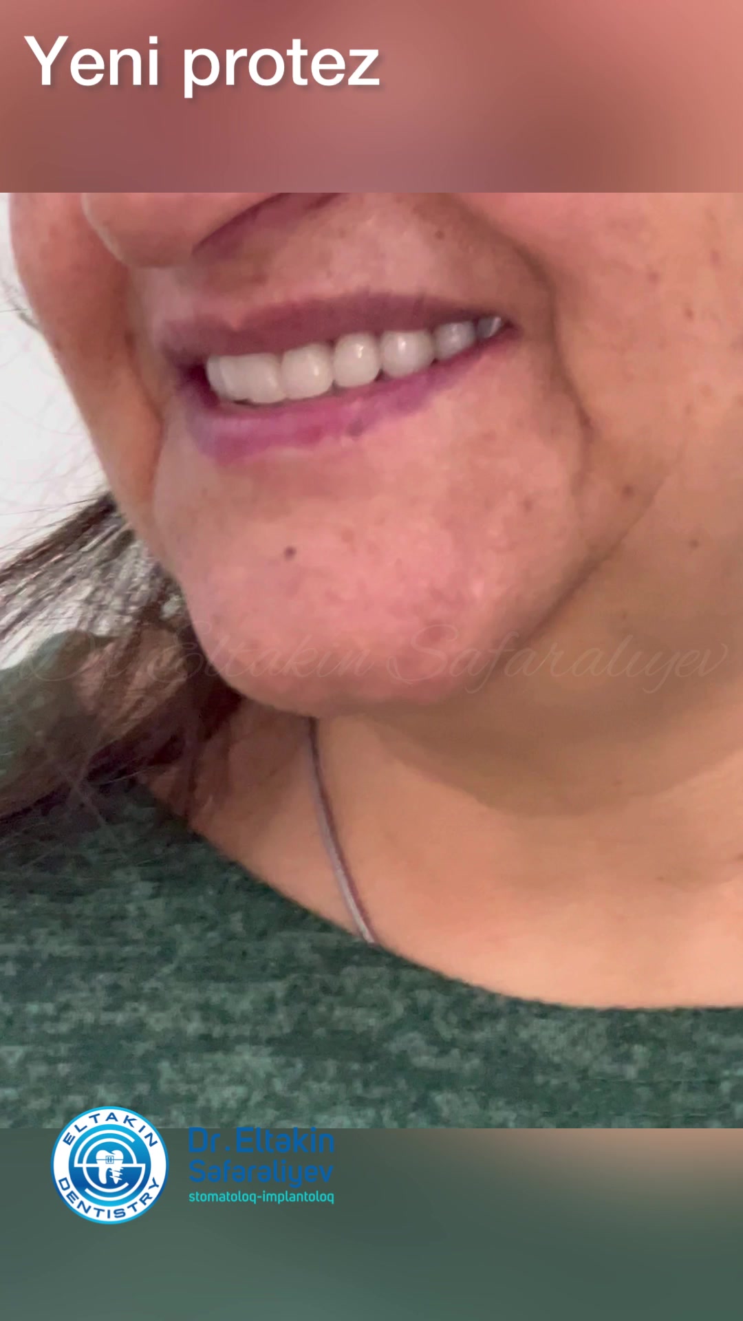@eltakindentistry