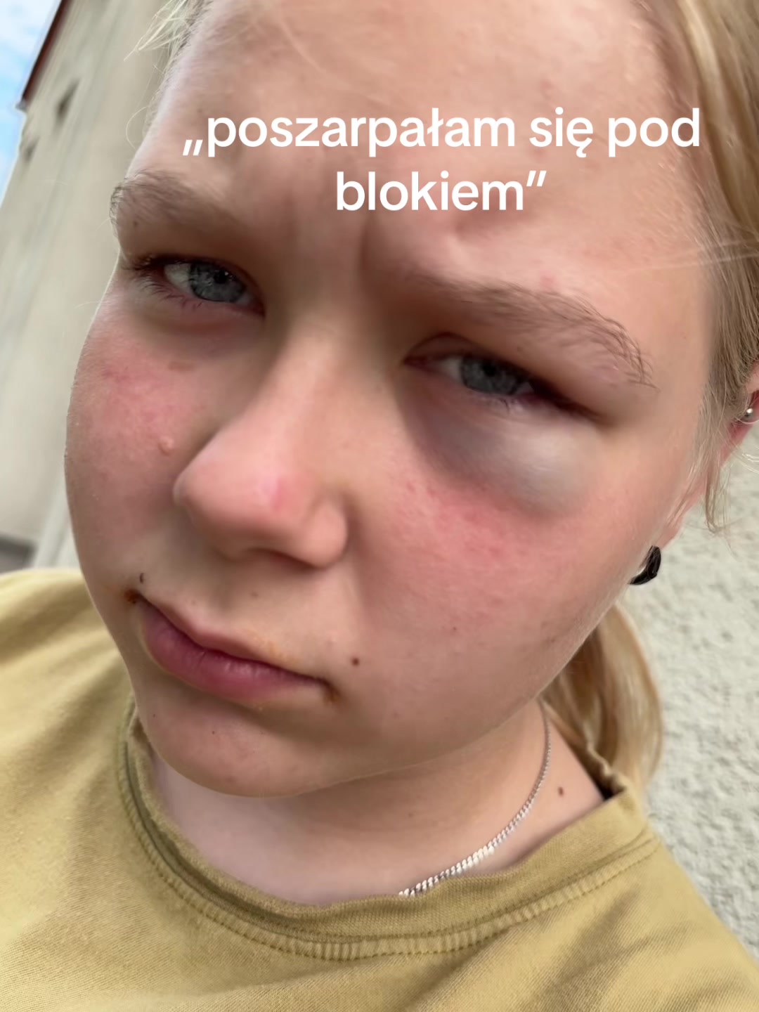 @ig:patinixr