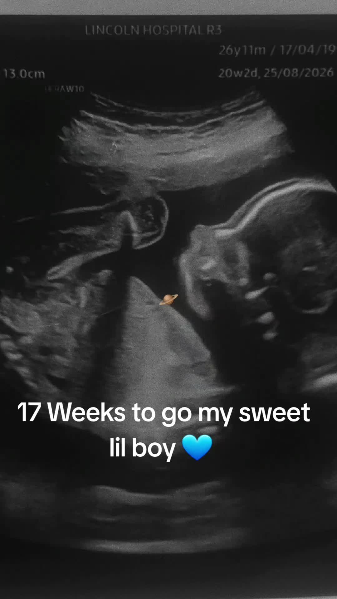 @Mummyto2boys💙💙