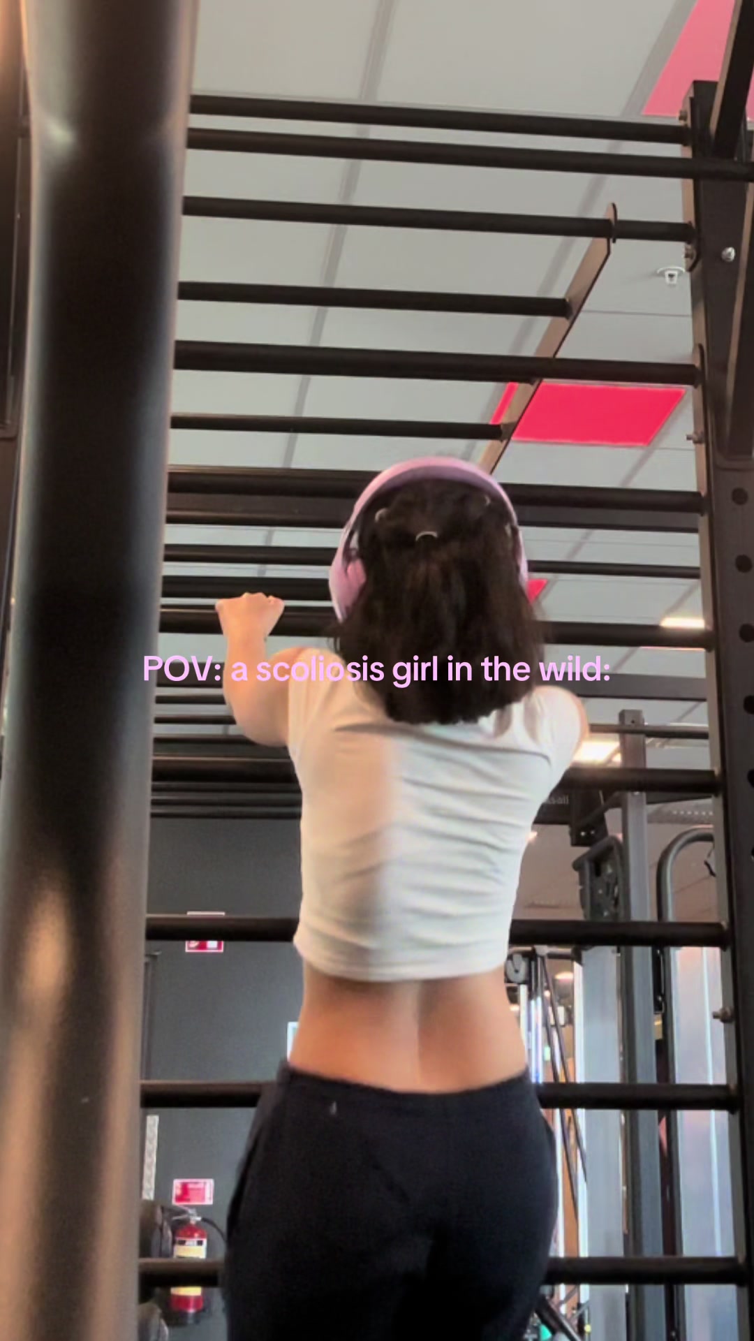 @Yasamin [Scoliosis]