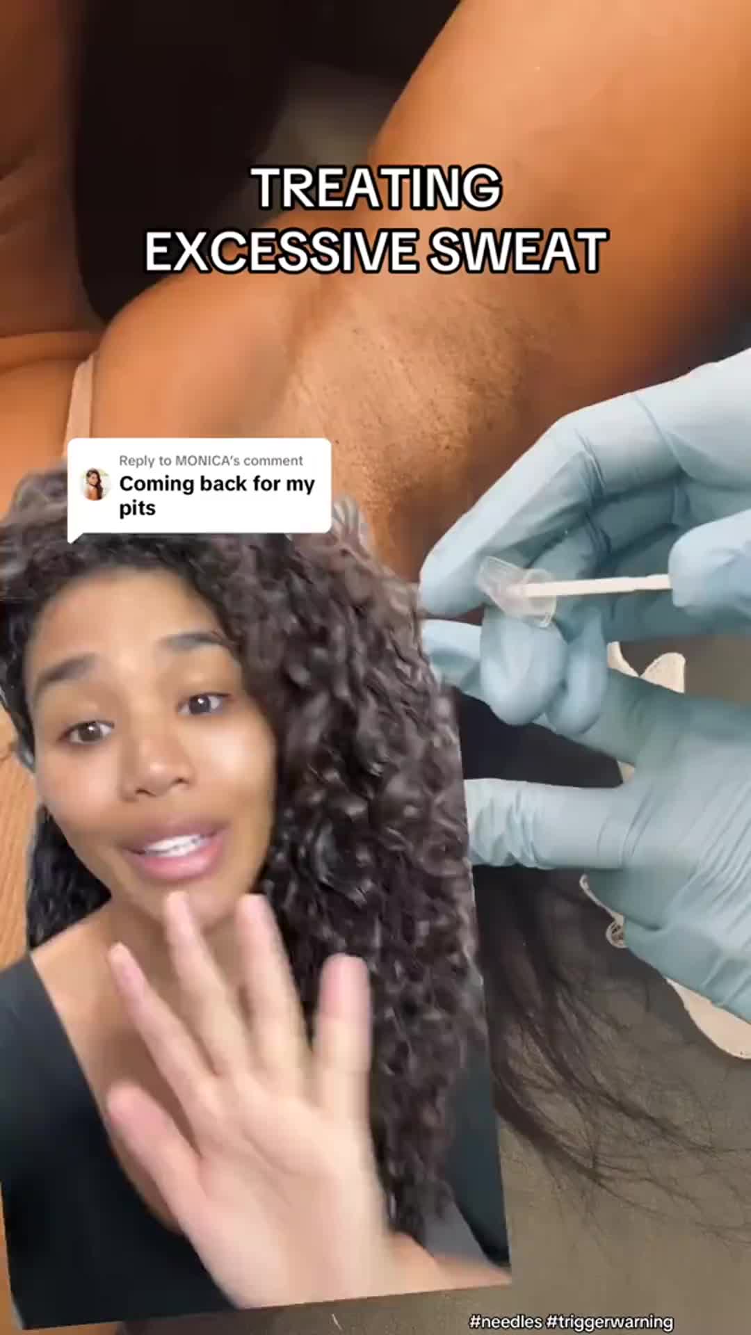 @Botox Filler Skin Los Angeles