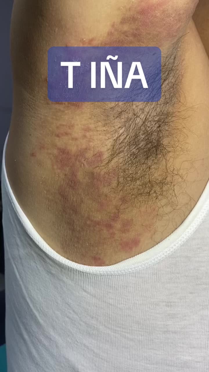 @dr.idrogodermatologo