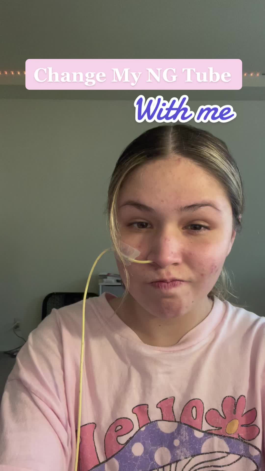 @Alexa