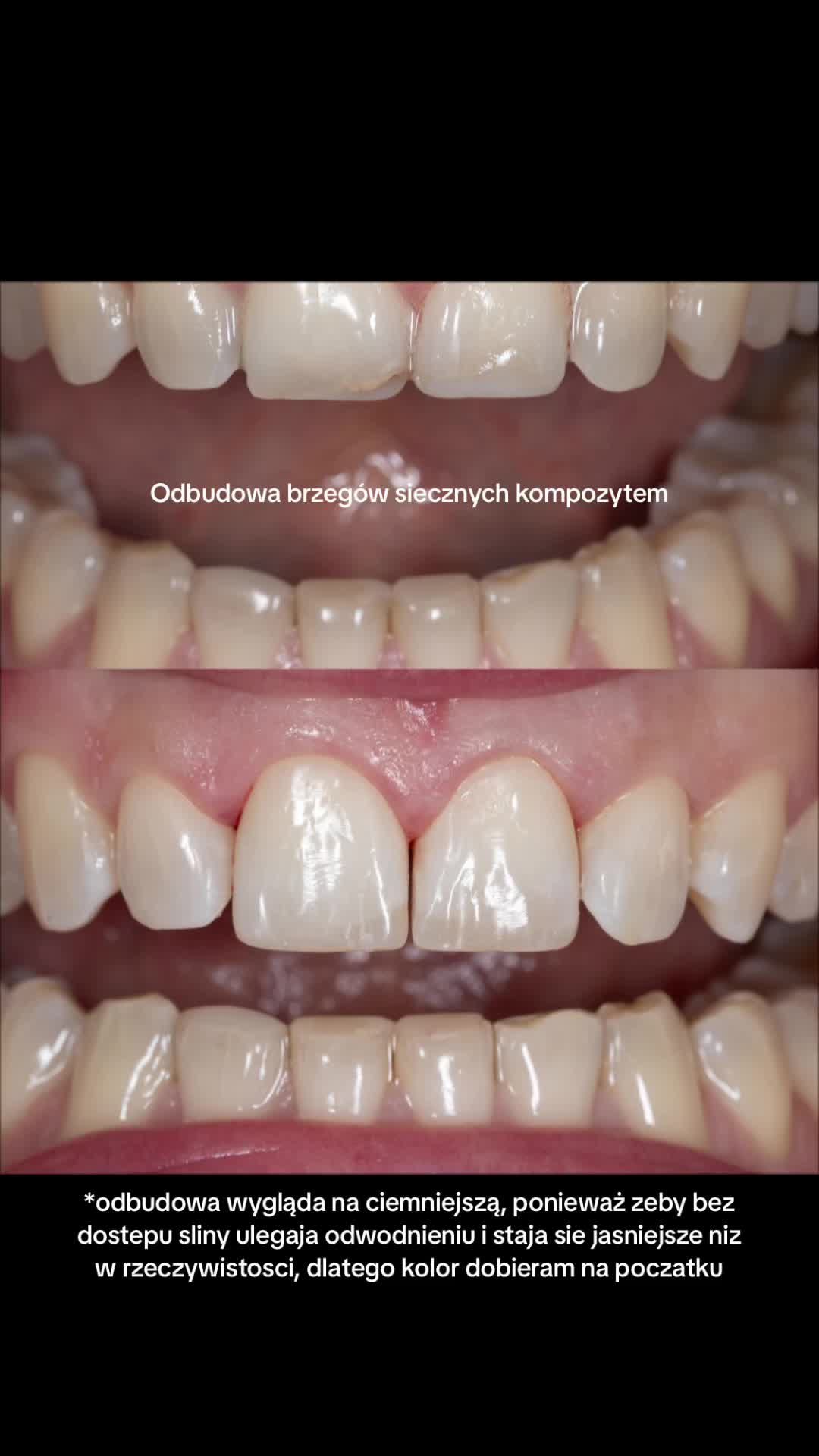 @Anna 🦷 dentystka