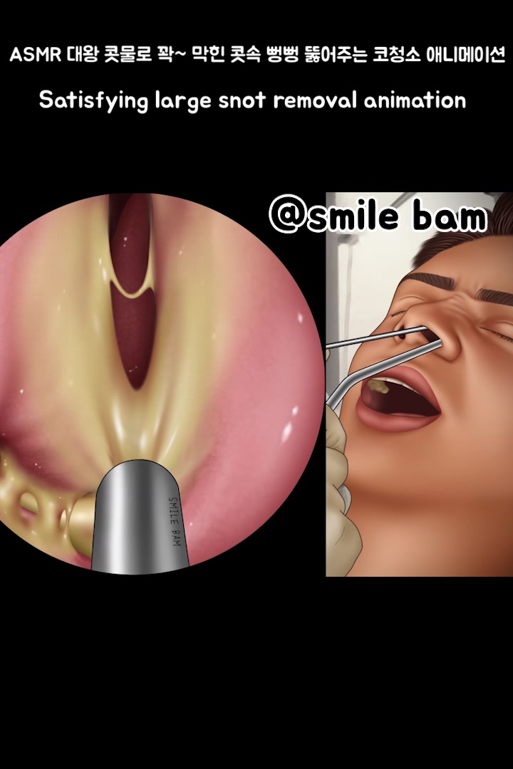 @Smile Bam