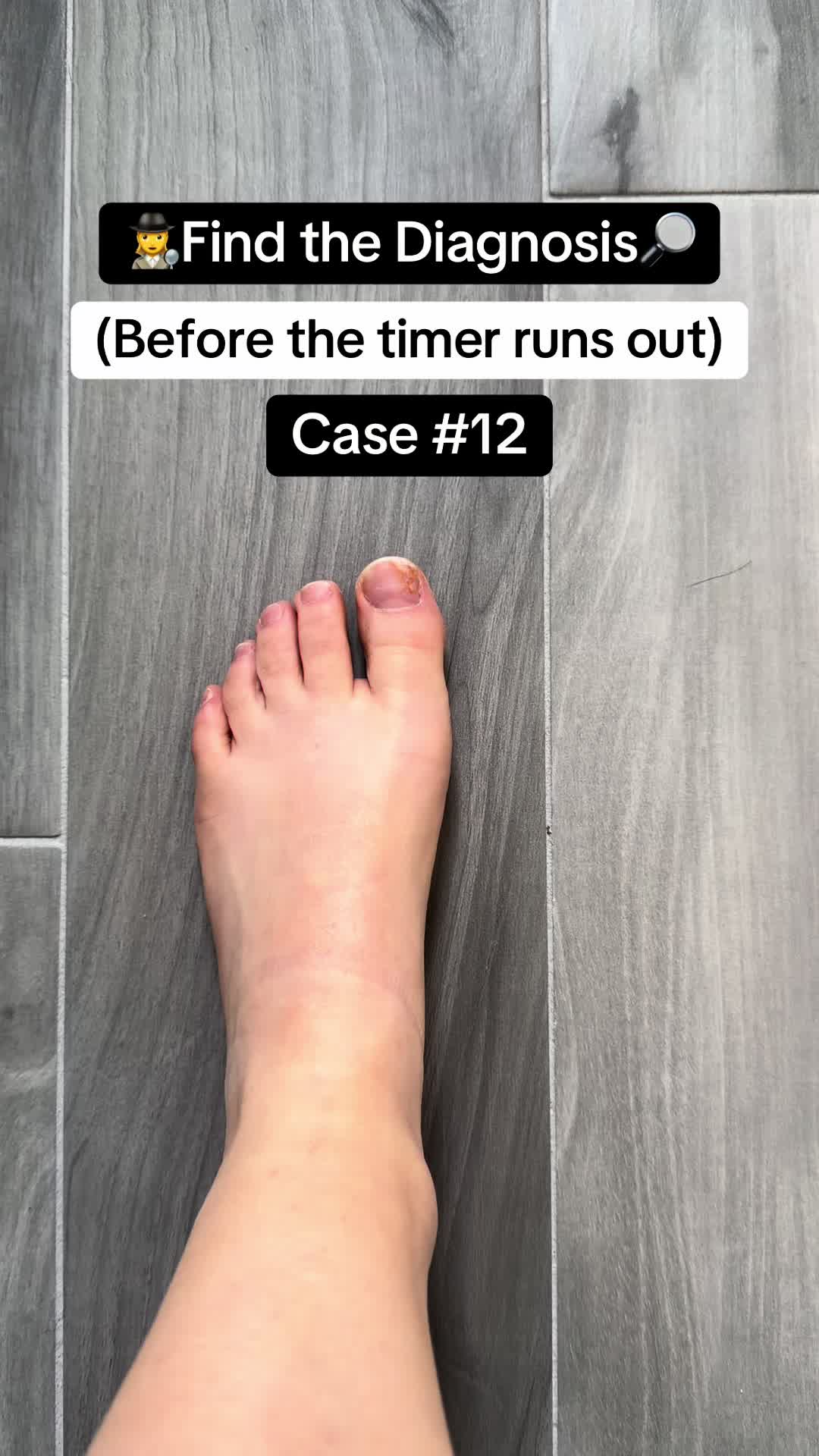 @StepSistersDPM