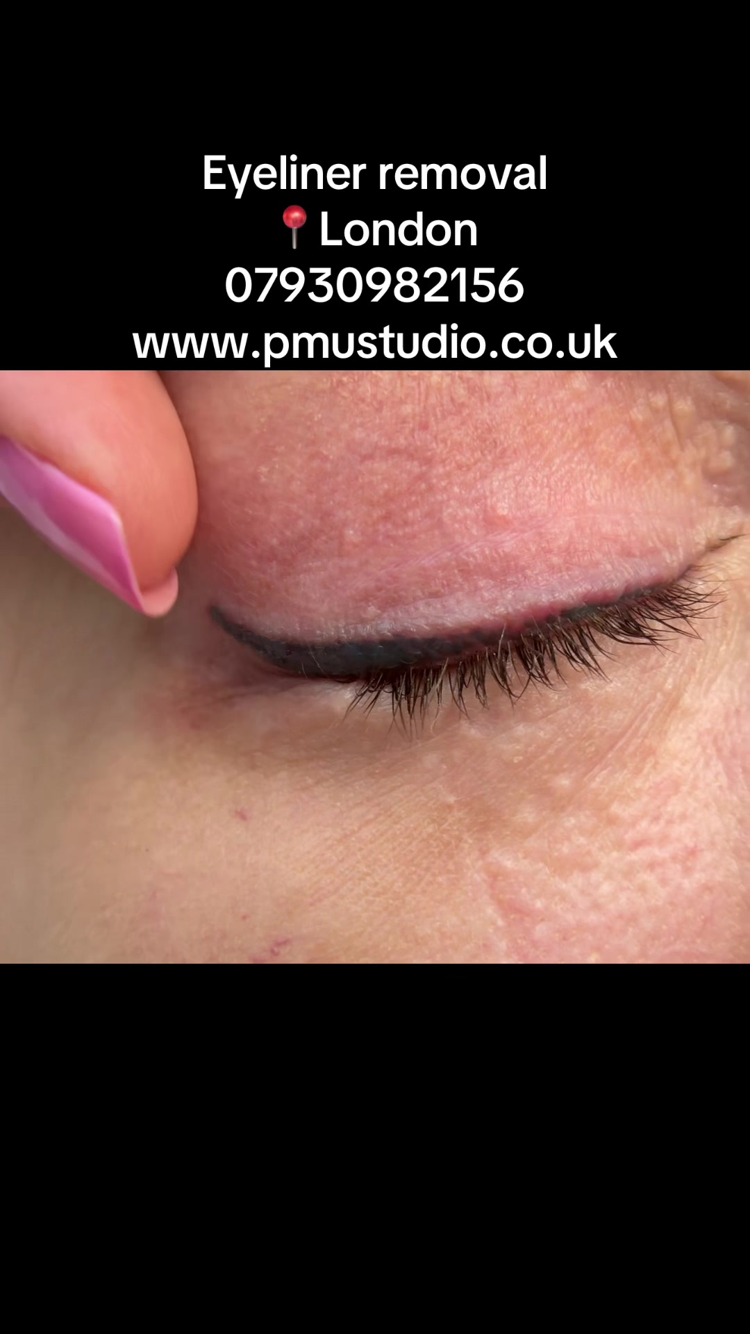 @Permanent Makeup & Removal