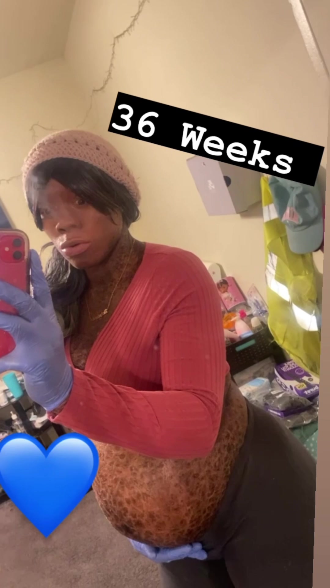 @Anthalayaha_