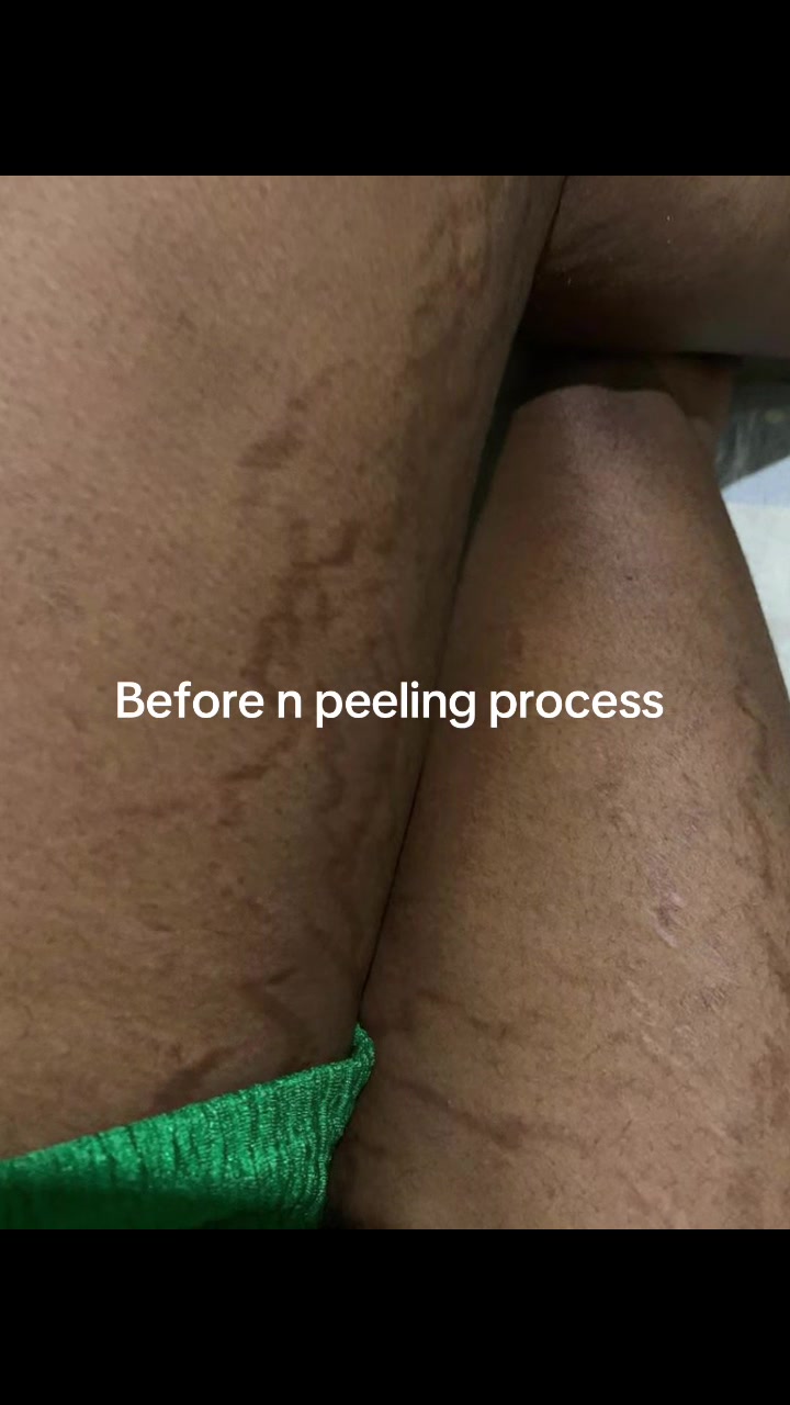 @@ Precious peeling soap