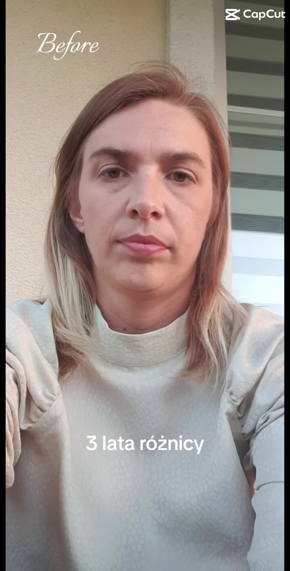 @Aneta