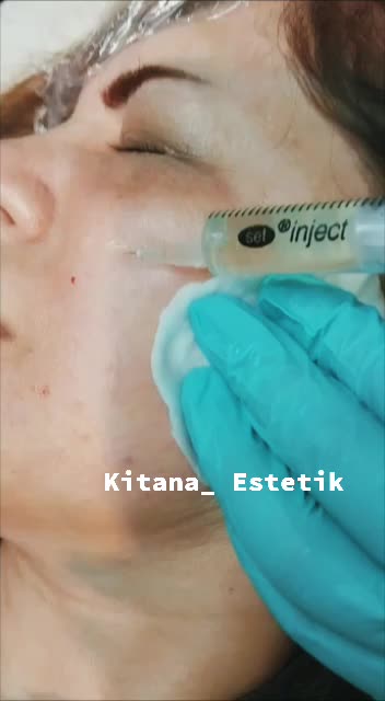 @kitanaestetik