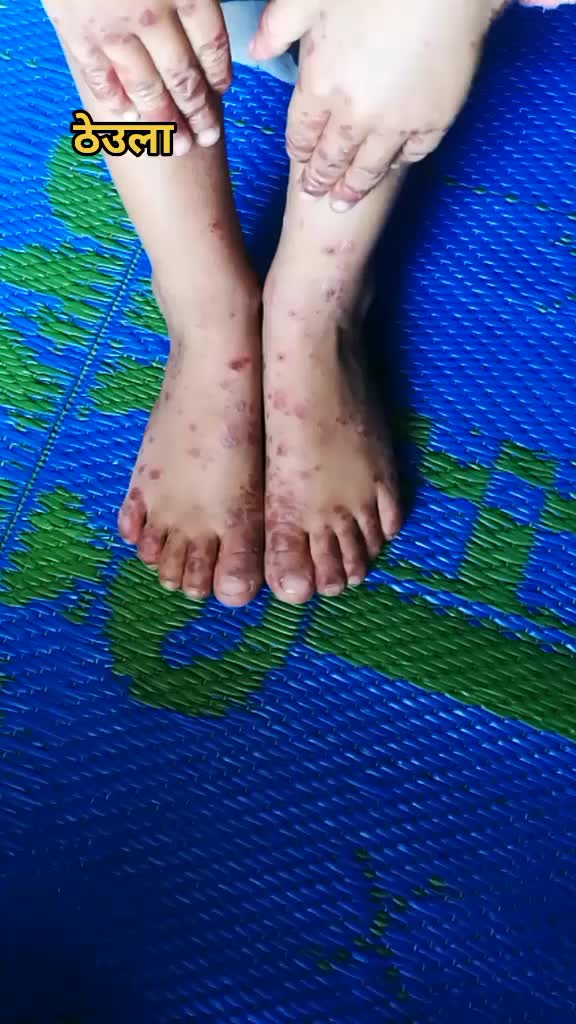@user852226