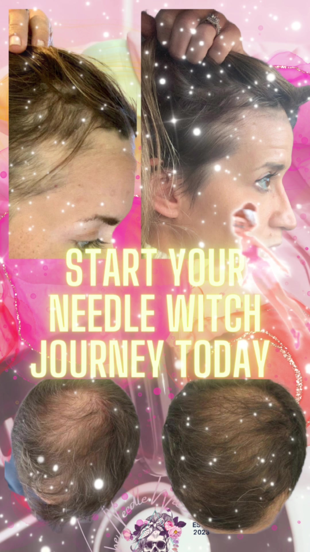 @The Needle Witch