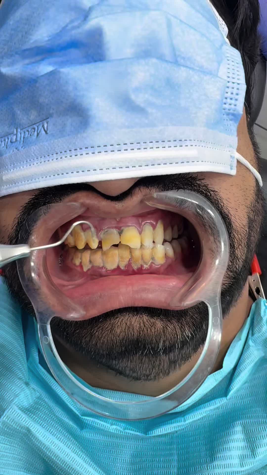 @Dr- syed numan official✅✅