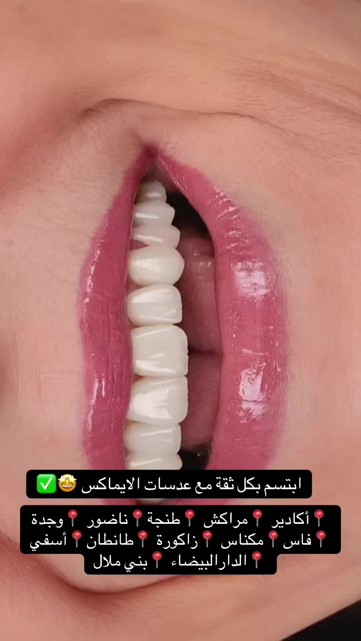 @brightsmileee1