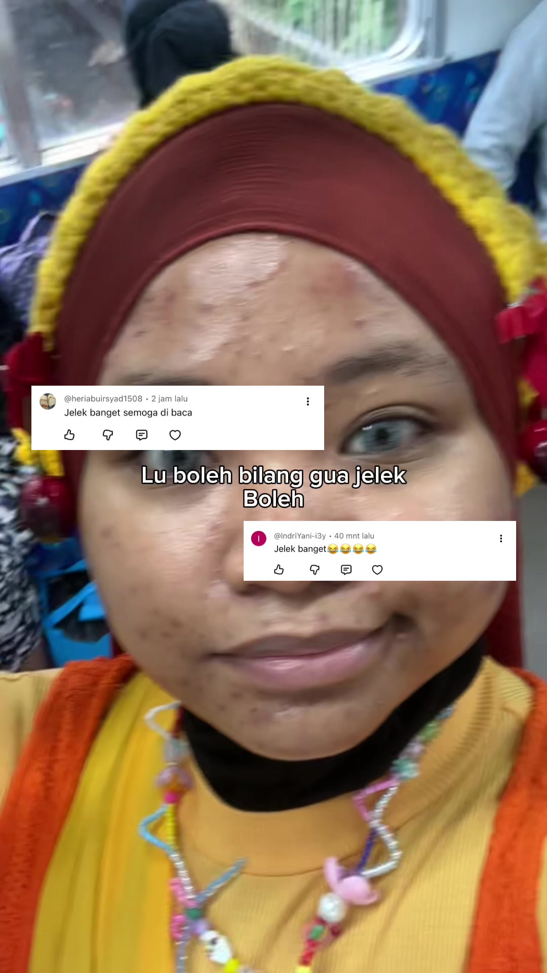 @MBAK CUNGCAT BAYI