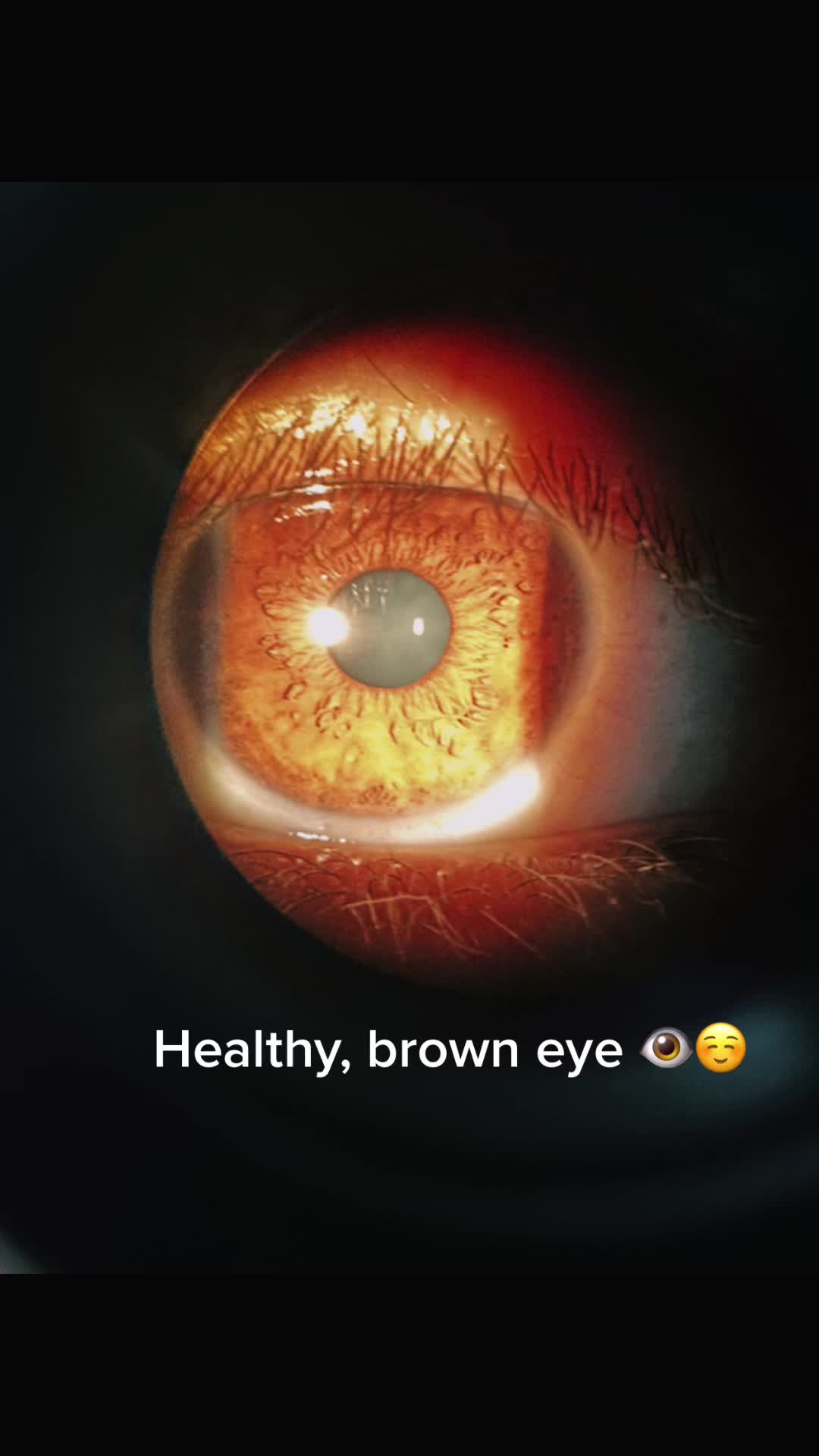 @yourcustomeyes