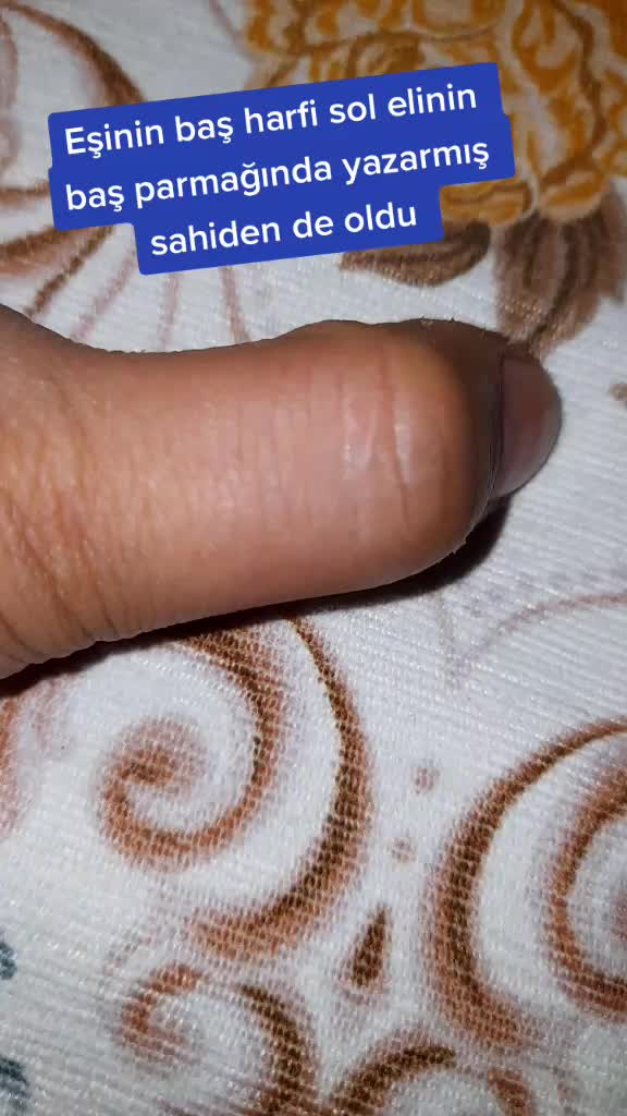 @RUKİYE YUSUF