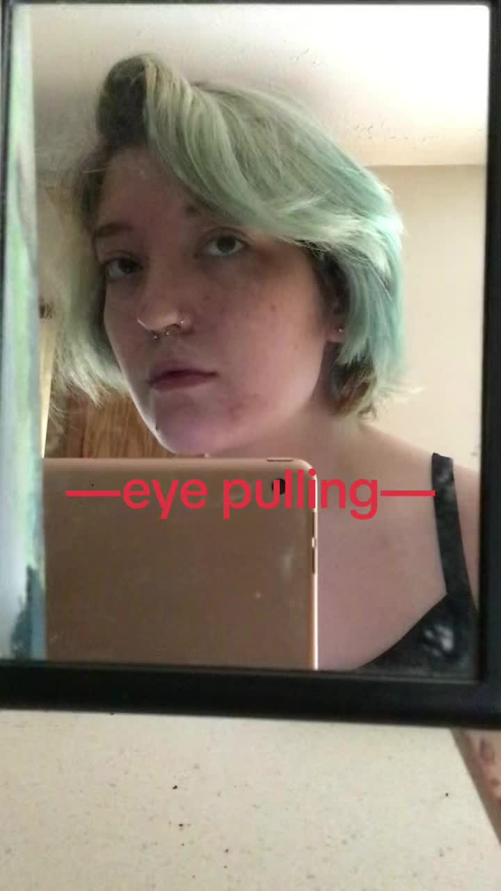 @Ally