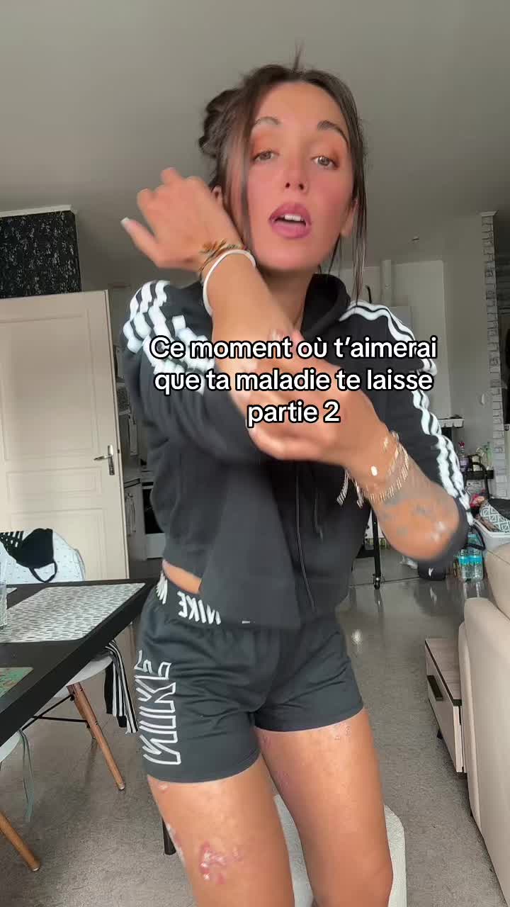 @lyla_psoriasistyle