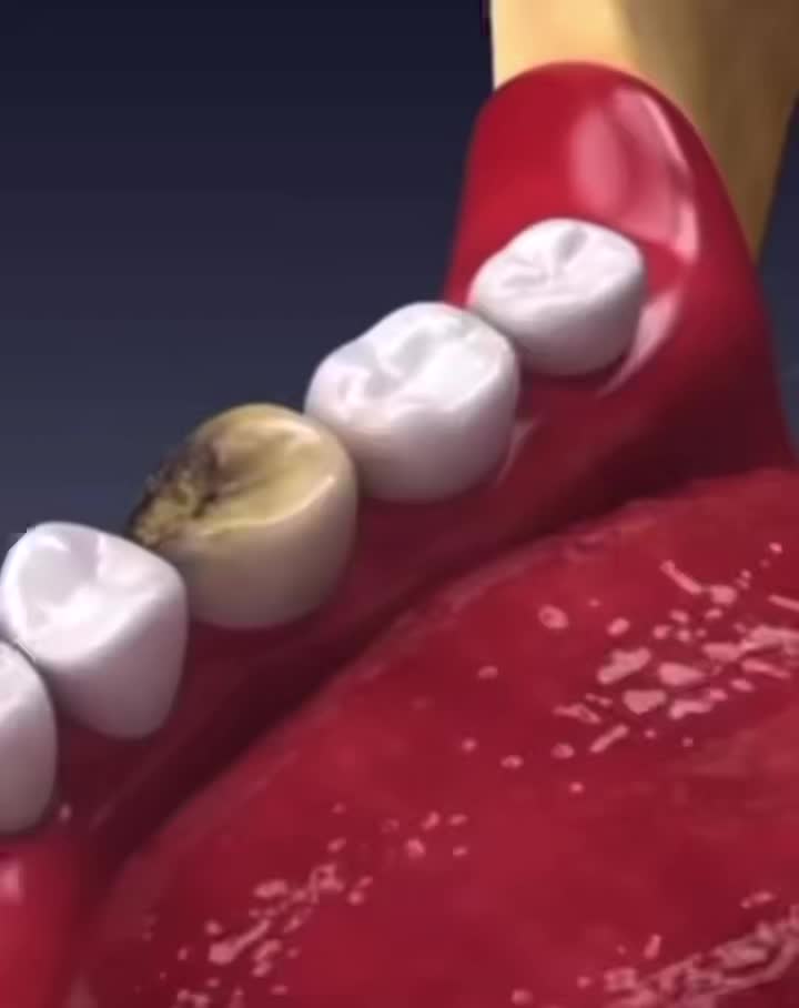 @Ben06