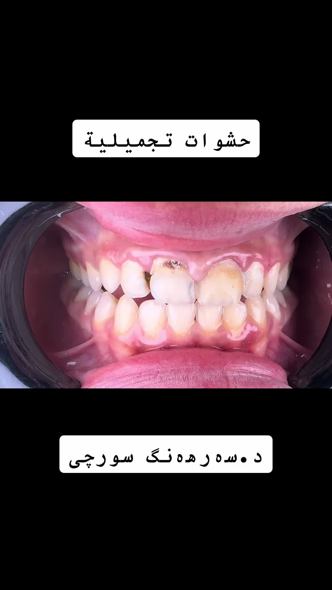 @Dr.Sarhang Surchi