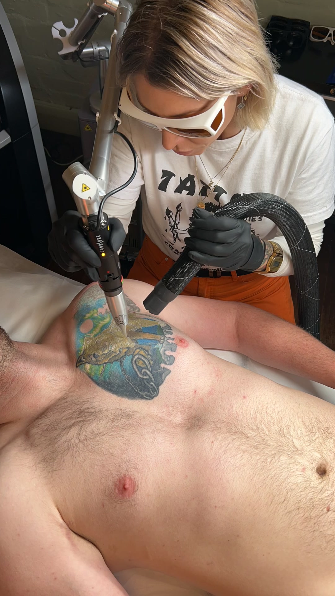 @Swift_tattoo_removal