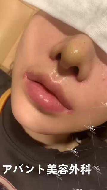 @Avant美容外科