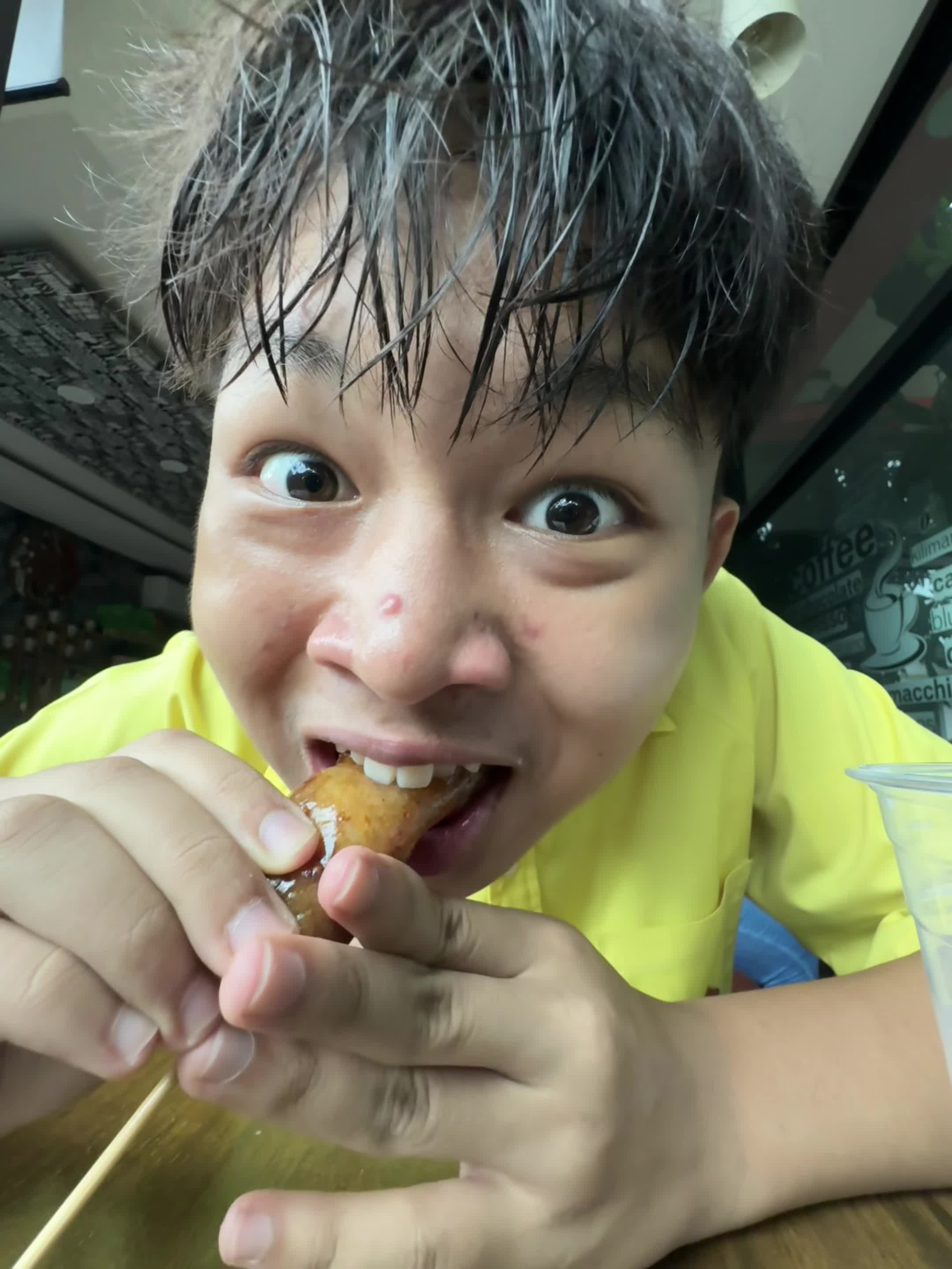 @มิกสิว!