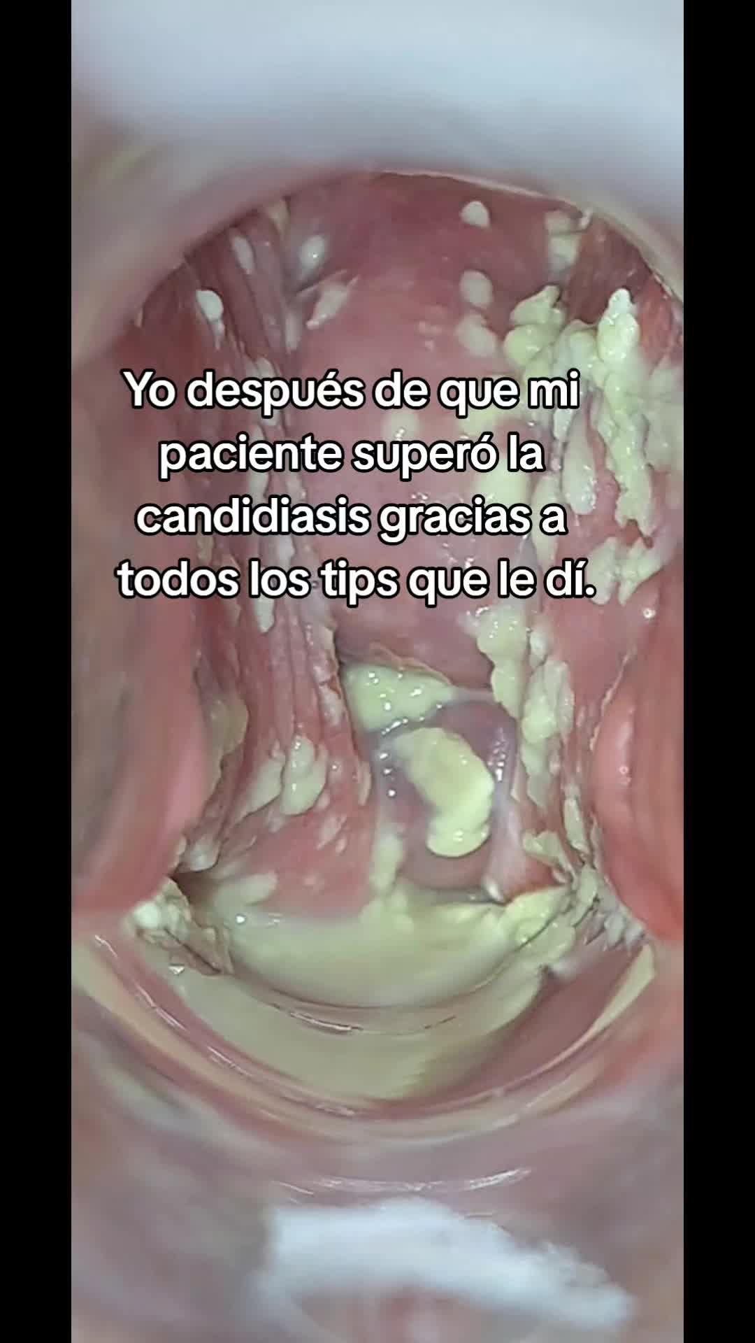 @OBST. KEYLA SALTOS