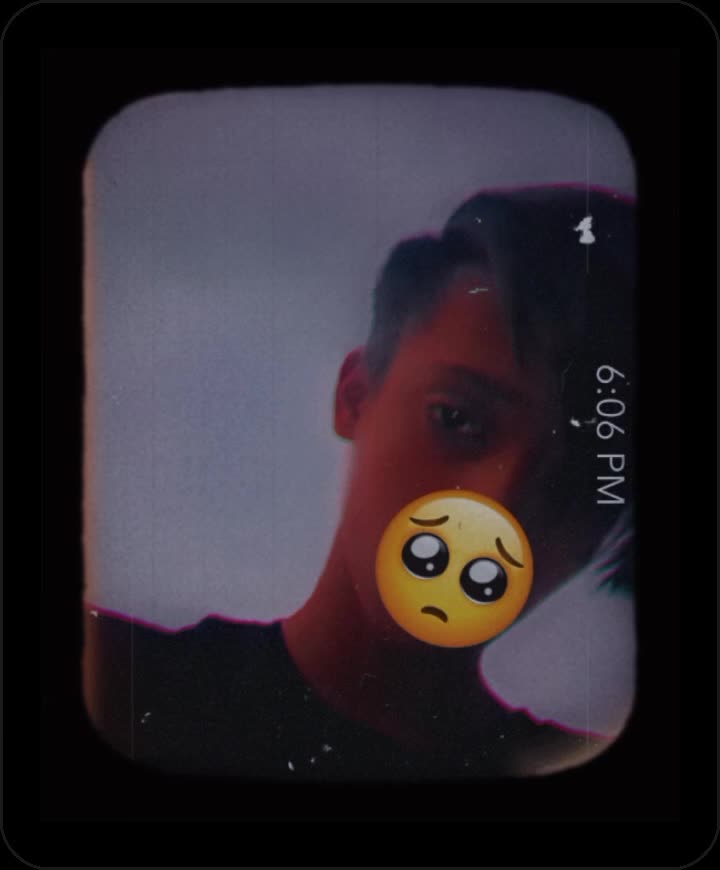 @Iᴛx_Sᴀᴍᴇᴇ_Eᴅɪᴛᴇʀ ❤️&zwj;🩹🥺