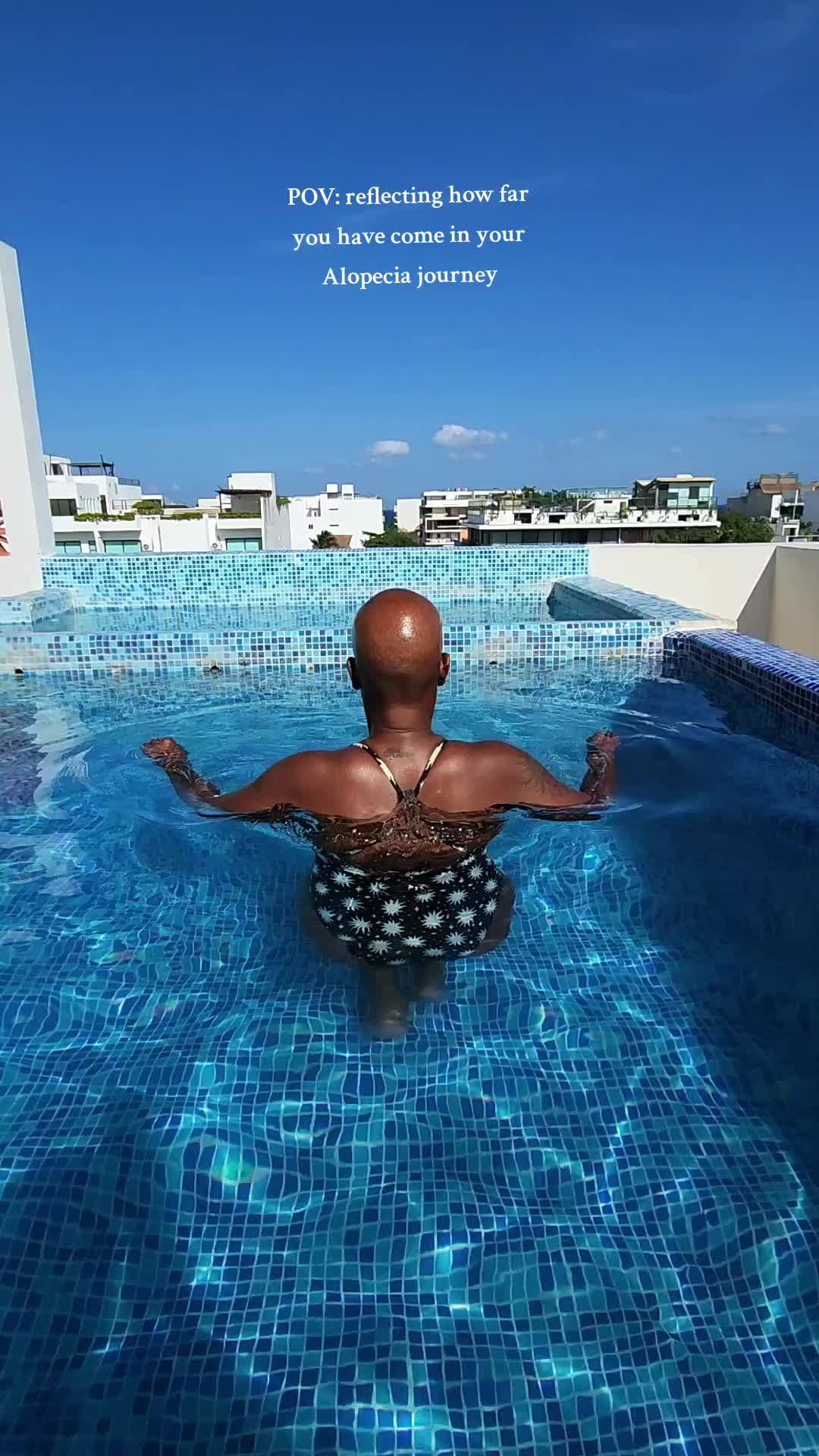 @Bald By Nature Not By Choice