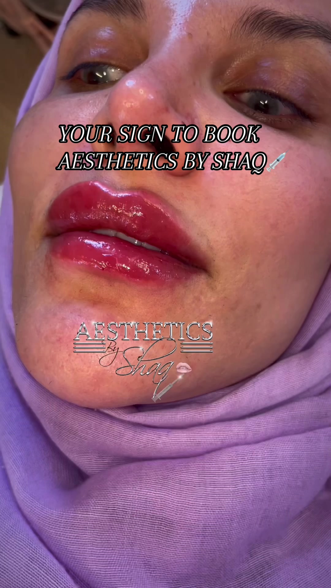 @Aestheticsbyshaq💉