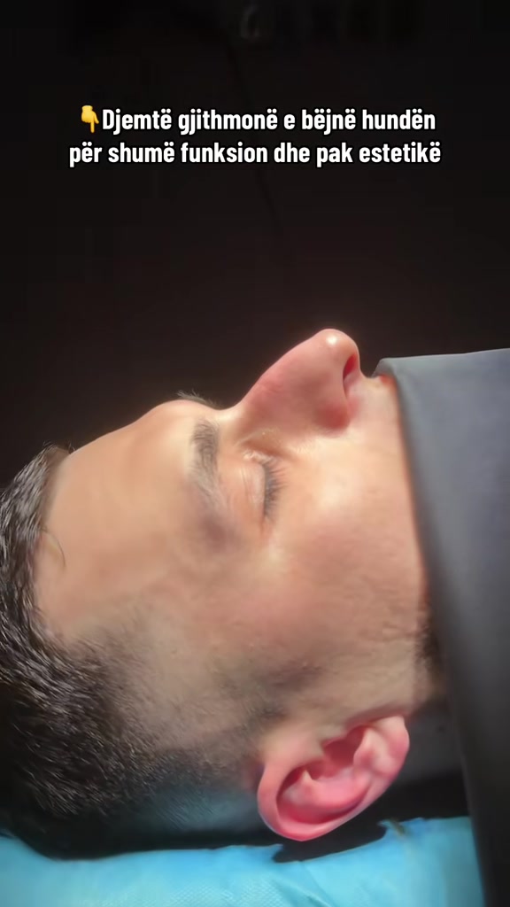 @rinoplasticatirana
