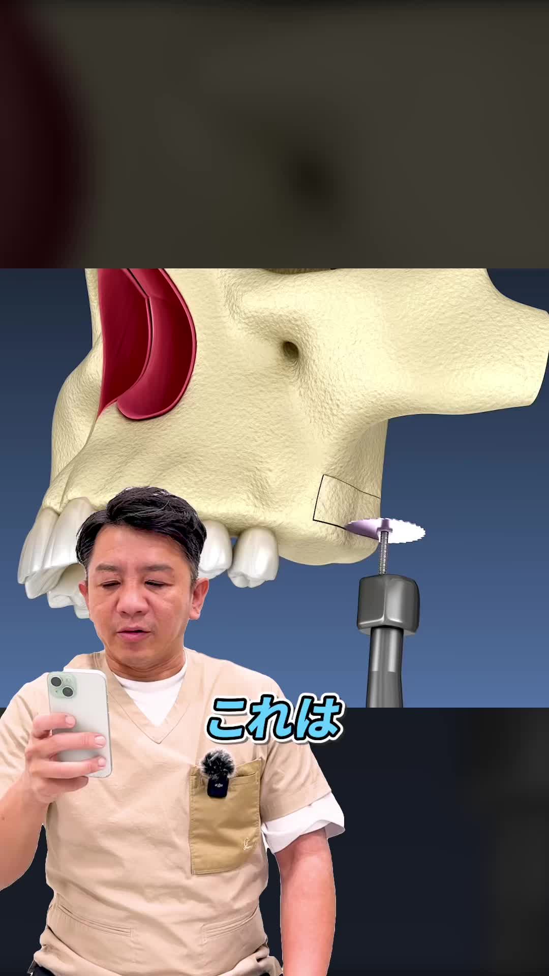 @セラミックの隼人先生