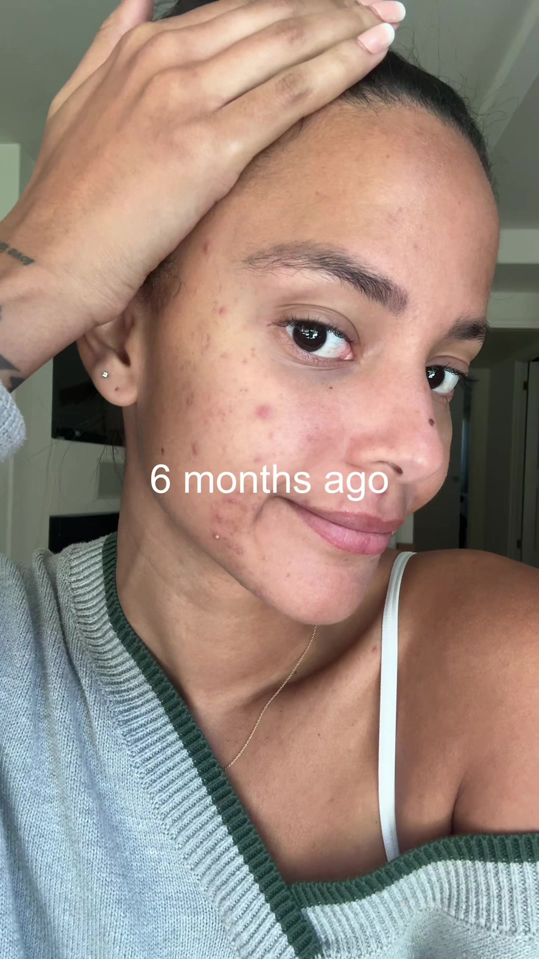 @KYRA