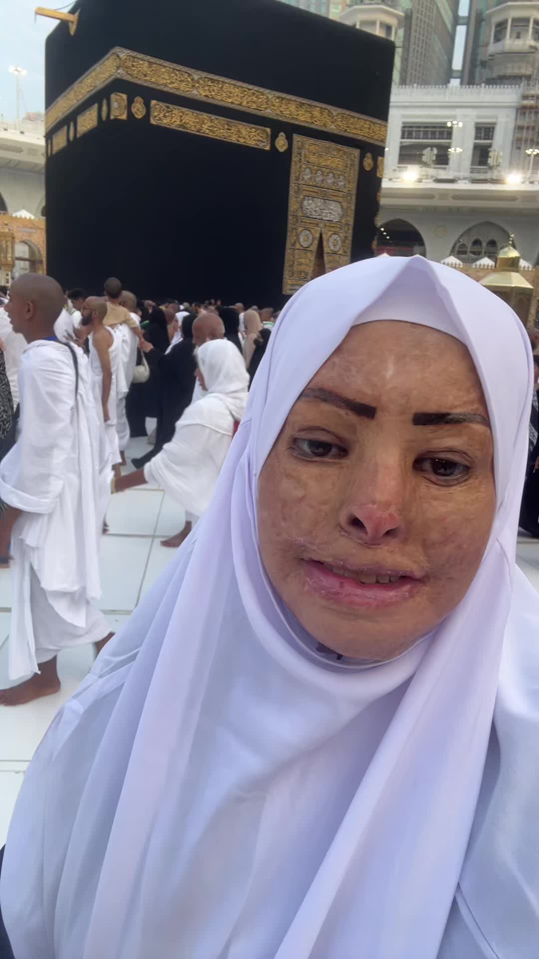 @Hedaya Mohmoud