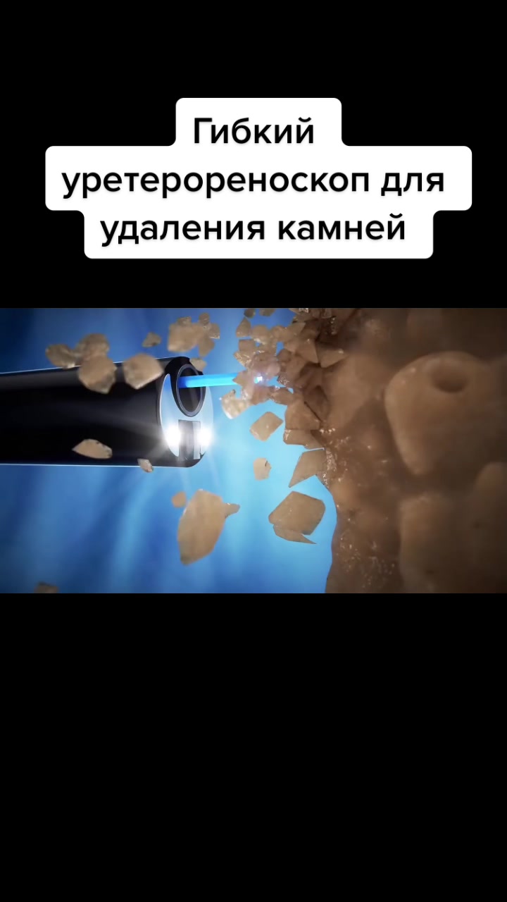 @Denis Davydov