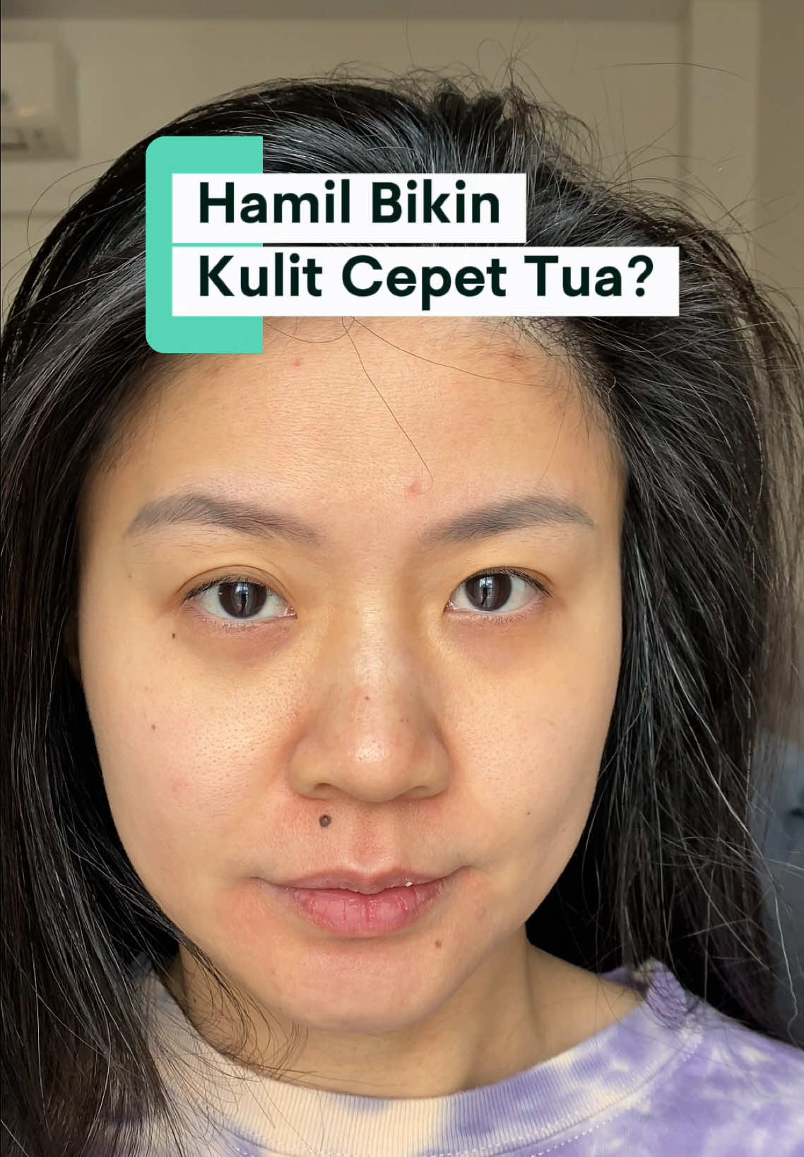 @Erlinachang
