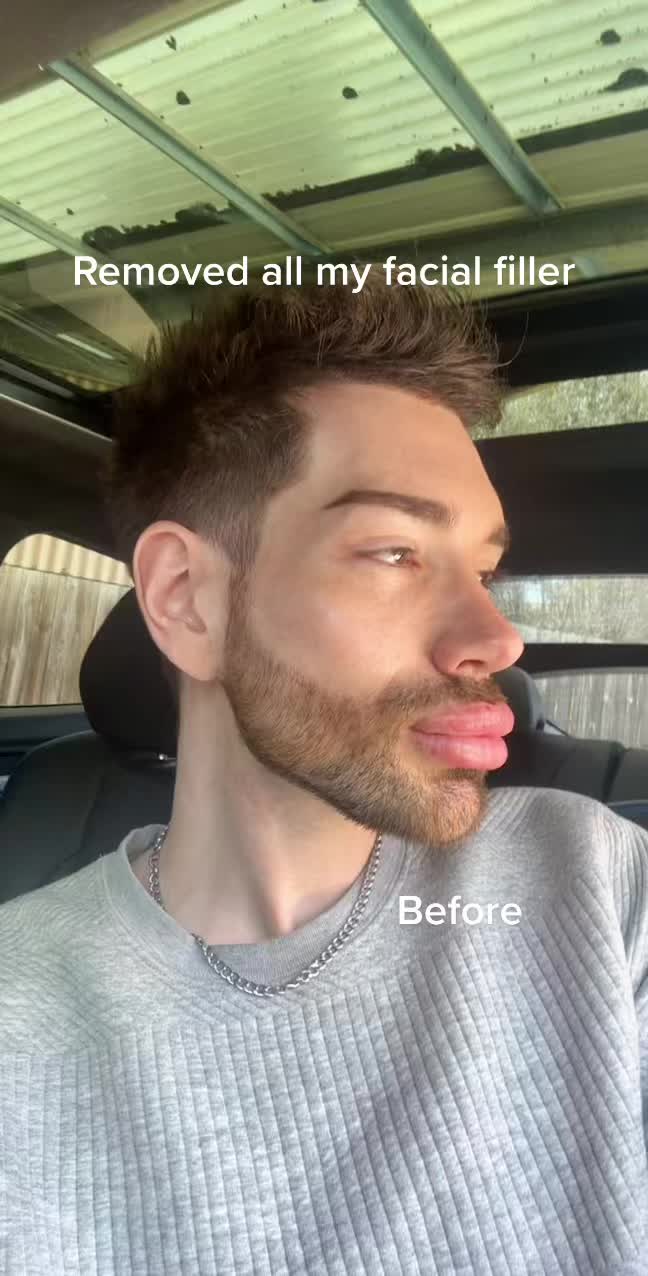 @DavidKosir