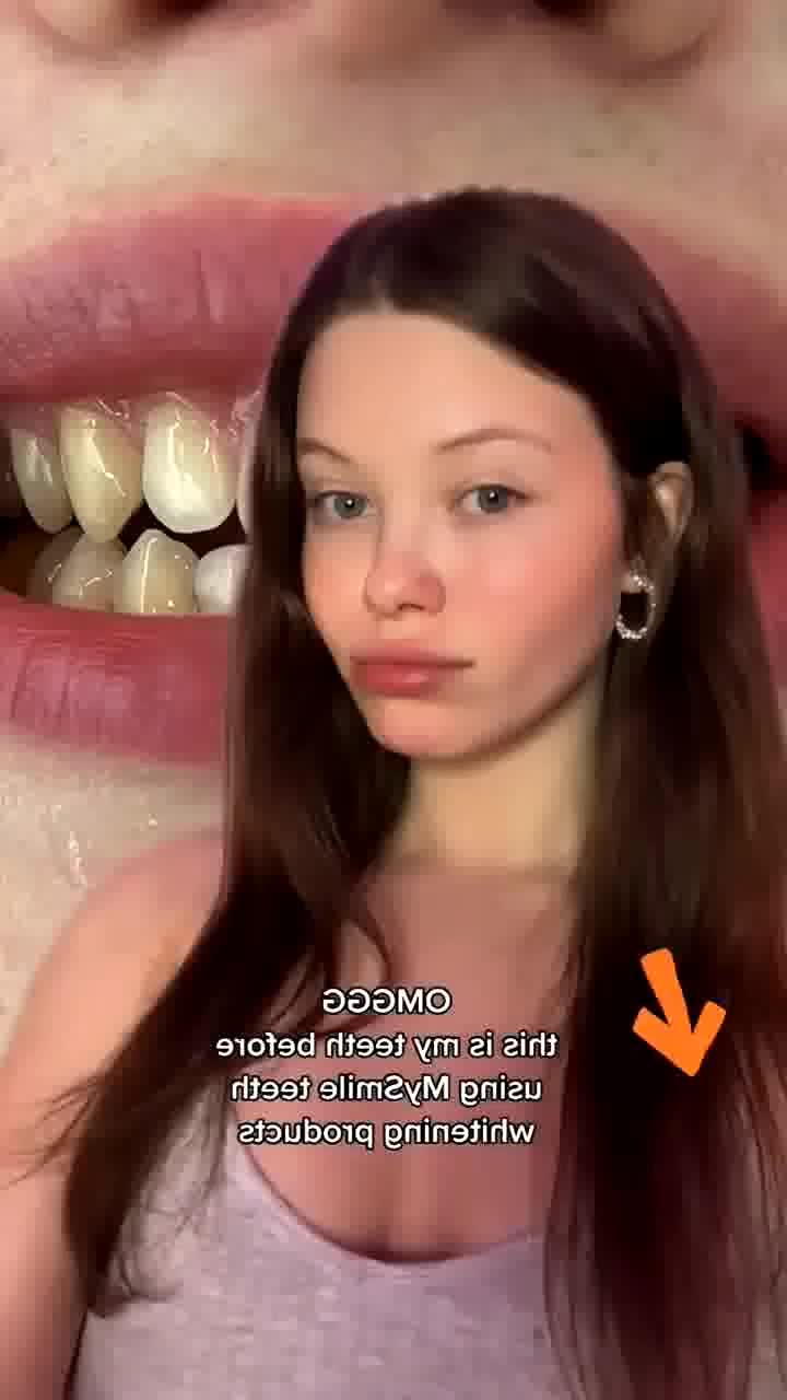 @annerjafjzv