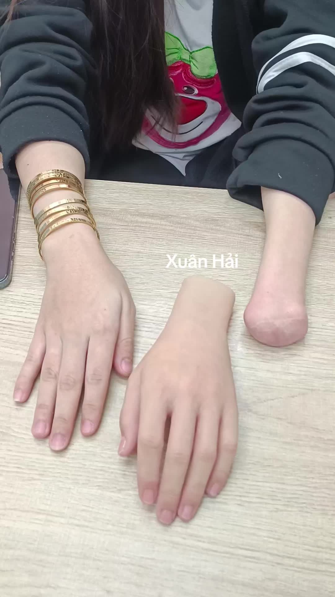 @Hải R&acirc;u Tay Ch&acirc;n Giả